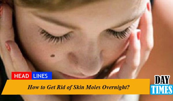 How to Get Rid of Skin Moles Overnight?