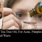 Uses of Tea Tree Oil, For Acne, Pimples, Hair, Nails and Warts