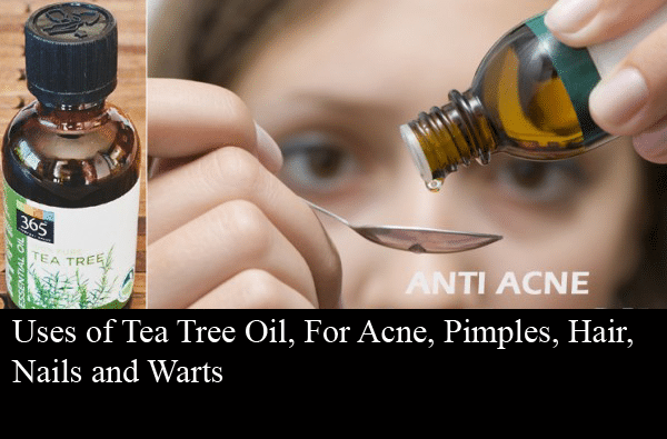 Uses of Tea Tree Oil, For Acne, Pimples, Hair, Nails and Warts