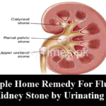 A Simple Home Remedy For Flushing Out Kidney Stone by Urinating
