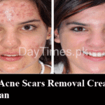 Top 5 Acne Scar Removal Creams in Pakistan