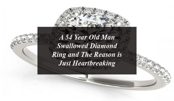 A 54 Year Old Man Swallowed Diamond Ring and The Reason is Just Heartbreaking