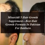 Minoxidil 5 Hair Growth Supplement---Best Hair Growth Formula In Pakistan For Baldness