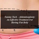 Tummy Tuck – Abdominoplasty: An Effective Treatment For Having Flat Belly