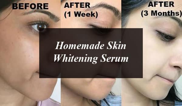 Homemade Skin Whitening Remedies And Treatments