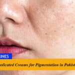 5 Best Medicated Creams for Pigmentation in Pakistan