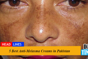 5 Best Anti-Melasma Creams in Pakistan