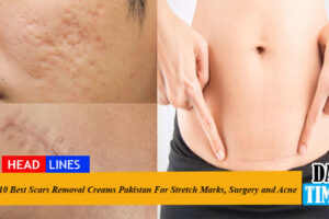 10 Best Scar Removal Creams in Pakistan For Stretch Marks, Surgery and Acne