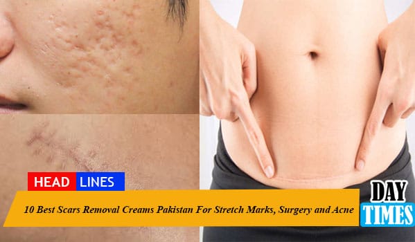 10 Best Scar Removal Creams in Pakistan For Stretch Marks, Surgery and Acne