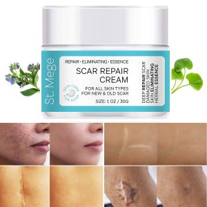 St. Mege Scar Removal Cream