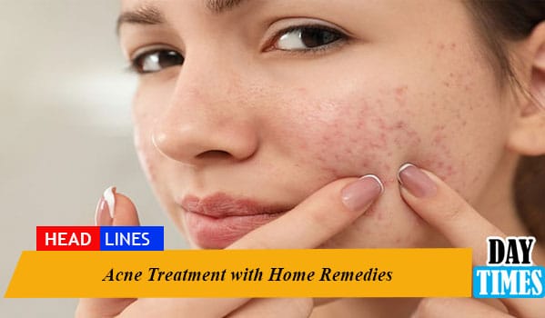 Acne Treatment with Home Remedies