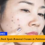 4 Best Dark Spots Removal Creams in Pakistan