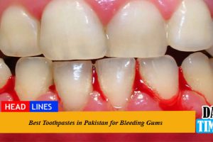 Best Toothpastes in Pakistan for Bleeding Gums