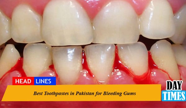 Best Toothpastes in Pakistan for Bleeding Gums