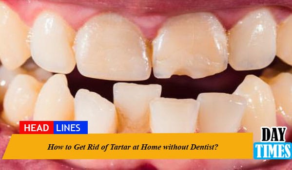 How to Get Rid of Tartar at Home without Dentist?