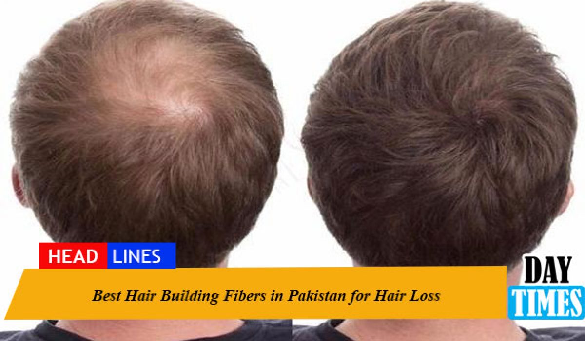 Best Hair Building Fibers in Pakistan for Hair Loss Best Hair Building Fibers in Pakistan for Hair Loss