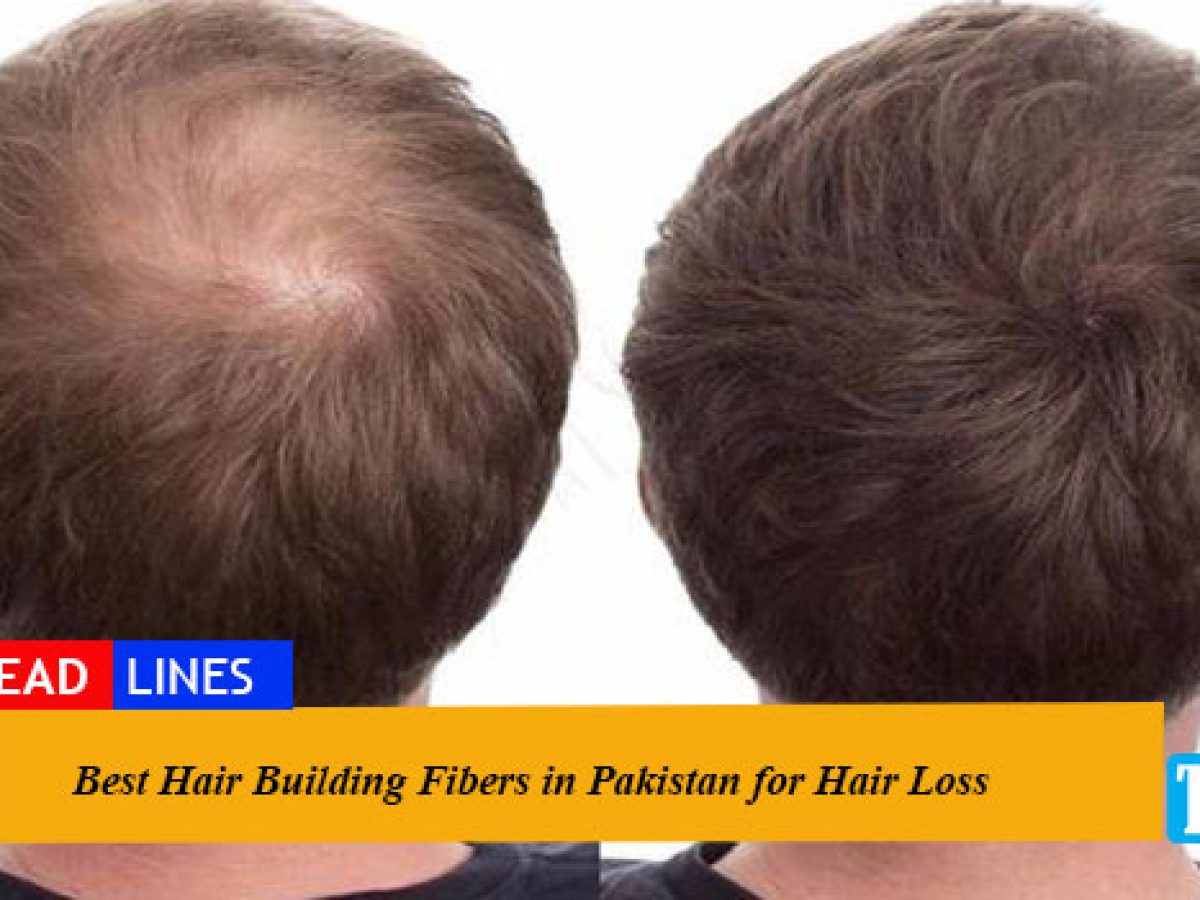 Febron Hair Building Fibers Does it Actually Work 2022  Hair Loss Geeks