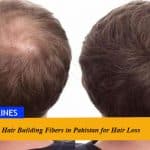 Best Hair Building Fibers in Pakistan for Hair Loss