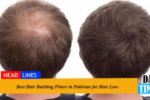 Best Hair Building Fibers in Pakistan for Hair Loss