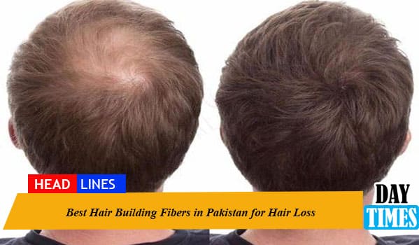 Best Hair Building Fibers in Pakistan for Hair Loss