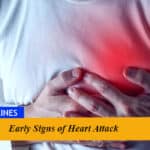 Early Signs of Heart Attack