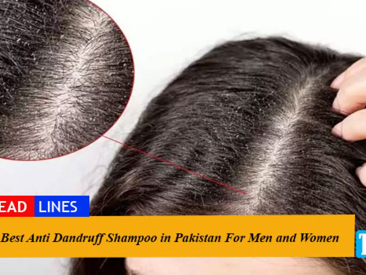 10 Best Anti-Dandruff Shampoos in Pakistan for Men and Women