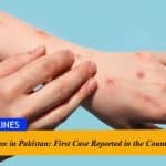 Monkeypox in Pakistan: First Case Reported in the Country