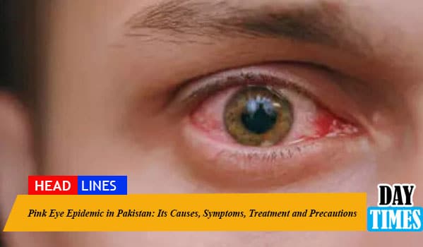 Pink Eye Epidemic in Pakistan: Its Causes, Symptoms, Treatment and Precautions 